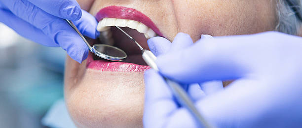 Best Emergency Wisdom Teeth Removal in South Lyon, MI